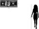 Classy Living Franklin Noir: $100 Bill Pop Art Wall Art-2
