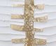 A & B Home Gold/White Ecomix Vase-1